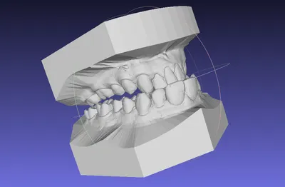 After Alignment